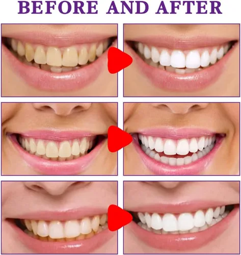Vista 4 de Pasta de dientes probióticos para el mal aliento, pasta de dientes equilibrada del aire del océano (2 piezas)