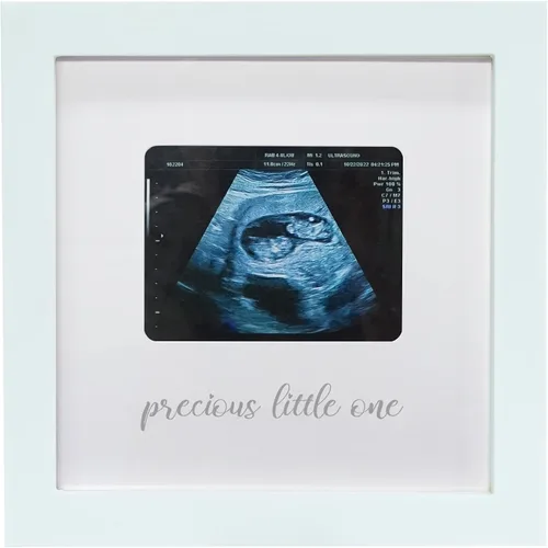 Vista 14 de Sonogram - Marco de fotos para abuela, marco de fotos de ultrasonido, anuncio de embarazo para abuela, ideas de anuncio de bebé, marco de fotos