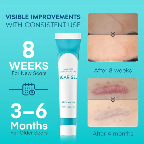 Vista 3 de Aroamas Scar Gel avanzado para cicatrices, gel de silicona de grado médico para ayudar a mejorar la apariencia de cicatrices y estrías para rostro
