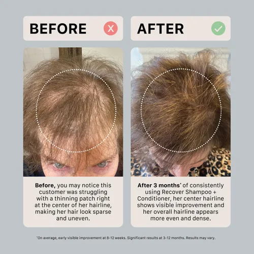 Vista 6 de ACTIIV Acondicionador de pérdida de cabello para recuperar el eng