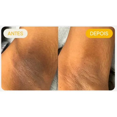 Vista 5 de Crema Adeus de Banano Correctora de Manchas Oscuras 3.53 oz - Original