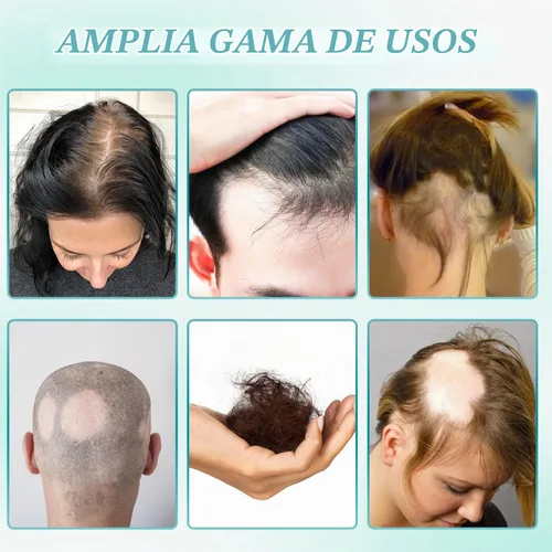 Vista 6 de 2 cremas de masaje para el cuero cabelludo al 5% del crecimiento del cabello, crema profesional para el cuidado del cabello, anti-pérdida de cabello