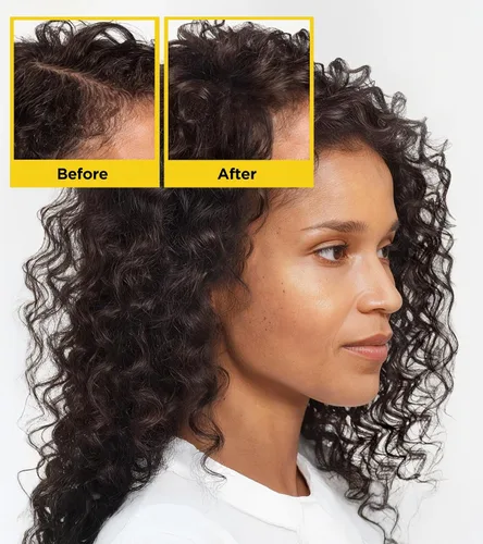 Vista 2 de Root Activator - Champú para el crecimiento del cabello con biotina, nutritivo domina el encrespamiento con HA&B5, champú anticaspa de romero