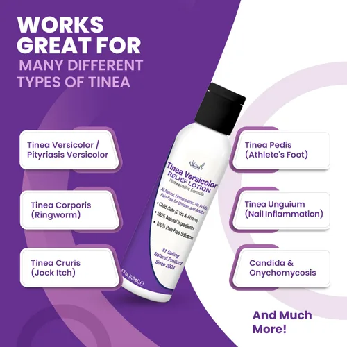 Vista 5 de Naturasil Tinea Versicolor Loción de tratamiento - Loción de azufre Max-Strength 10x para alivio antifúngico de acción rápida Alivia y restaura