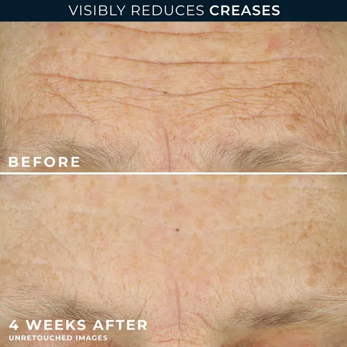 Vista 10 de RoC Crepe Repair Crema hidratante facial diaria antienvejecimiento y crema reafirmante para el cuello (1.7 onzas) + cápsulas suavizantes RoC Retinol