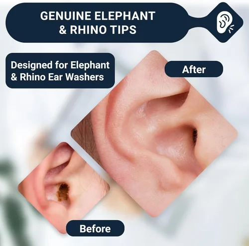 Vista 4 de Tips para lavar desechables Elephant & Rhino para orejas de Doctor Easy, bolsa de 20