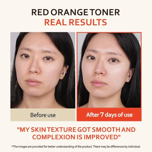 Vista 3 de T'else Tónico de niacinamida rojo naranja de 5.1 fl oz, 5.2 onzas líquidas, tonificante vitalizante esencia facial, suavizante textura de la piel