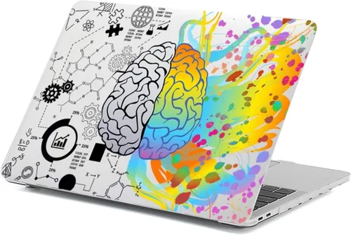 Vista 14 de Funda para MacBook Air de 15,3 pulgadas M2/M3/M4/M5, lunares Amarillo (Yellow Polka Dot)