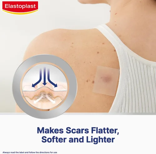 Vista 4 de Elastoplast Yesos reductores de cicatrices (21 piezas), tratamiento rápido y cómodo para cubrir cicatrices, hojas de cicatrices para reducir