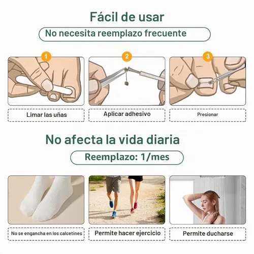 Vista 4 de Corrector de uñas encarnadas de nitinol dual, tratamiento de uñas encarnadas, enderezador de uñas curvas, kit de eliminación de uñas encarnadas