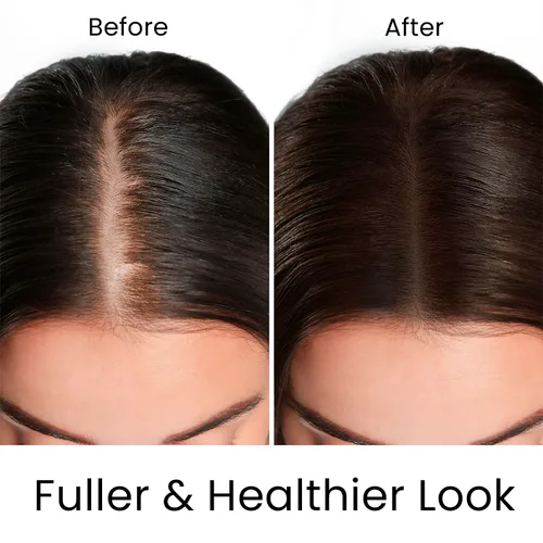 Vista 4 de MOEHAIR Champú Hair Guard Estimula los folículos pilosos Champú engrosador y voluminizador del cabello Infundido con aceite de argán, ginseng