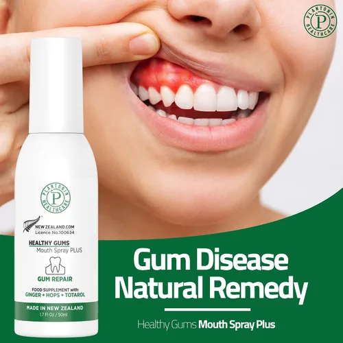 Vista 3 de Spray de enjuague oral para enfermedades de las encías y tratamiento de la gingivitis para adultos, 1.7 fl oz, 142 porciones, alternativa natural