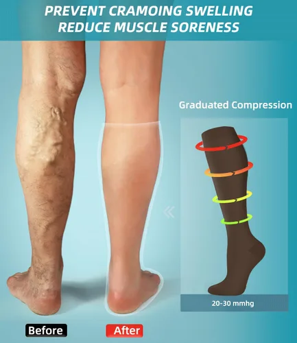 Vista 3 de FuelMeFoot Calcetines de compresión - 20-30mmHg Soporte graduado para hombres y mujeres, ideales para fútbol, correr y enfermeras