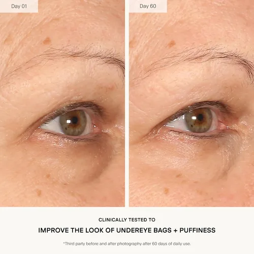 Vista 4 de U Beauty The RETURN Eye Concentrate - Crema antienvejecimiento para ojos con péptidos y antioxidantes para más brillante y tenso debajo de los ojos