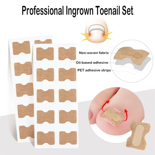Vista 5 de Juego profesional de uñas encarnadas con tiras transpirables de uñas encarnadas, tiras correctoras de uñas de los pies, parche corrector de uñas