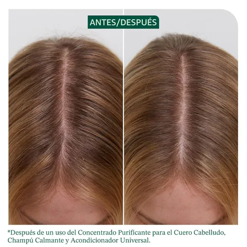 Vista 2 de Biolage Scalp Sync Universal Conditioner - Nourishing & Hydrating for All Scalp Types, Lightweight Moisturizing & Conditioning, Fermented Tea Blend