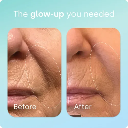 Vista 3 de Biosil Healthy Aging - 60 cápsulas - Belleza, vitalidad y apoyo para la tiroides - con Ch-OSA y selenio patentados - Suministro para 30 días