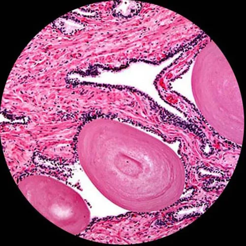 Vista 4 de AmScope Microscopio monocular compuesto de doble visión D120-MS, aumento 40X-1000X, Brightfield, condensador Abbe de 1,25 NA, etapa mecánica
