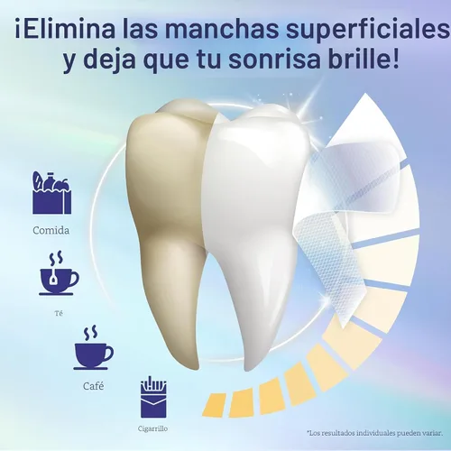 Vista 7 de GuruNanda Aceite de coco para jalar, aliento fresco y blanqueamiento bucal, 16 onzas líquidas y tiras blanqueadoras de dientes GuruNanda