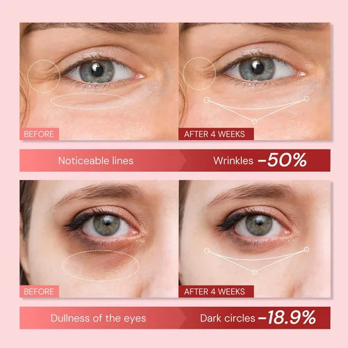 Vista 2 de Crema de ojos Retinol antienvejecimiento: tensor instantáneo de ojos y crema hidratante reparadora de arrugas - Tratamiento de bolsas debajo