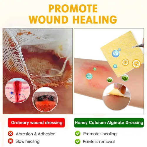 Vista 5 de Apósito para heridas de alginato de calcio y miel de Manuka, 3 x 3 pulgadas, paquete individual de 6 unidades - Cuidado de heridas para curación
