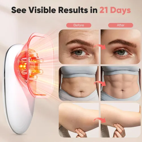 Vista 3 de Masajeador eléctrico 3 en 1 para la celulitis, máquina de esculpir el cuerpo 3 en 1 para estómago, cintura, brazos, piernas, herramienta de masaje