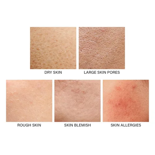 Vista 2 de Tratamiento de piernas de fresa, crema rejuvenecedora de piel de brazo de fresa con niacinamida, tratamiento hidratante de piel de pollo