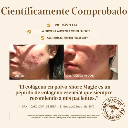 Vista 4 de Shore Magic Paquetes de colágeno de 14 días – Péptidos de colágeno marino hidrolizados tipo I, II, III, IV – Pescado capturado en la naturaleza, sin