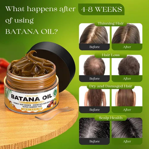 Vista 4 de GREEONIL Aceite de batana para el crecimiento del cabello, 100 % puro, prensado en frío, tratamiento orgánico para el cabello y cuero cabelludo
