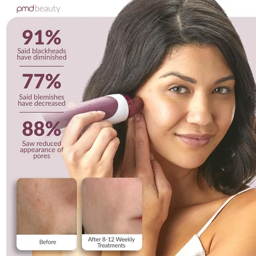 Vista 4 de PMD Beauty Personal Microderm Pro - At-Home Use, Facial Exfoliator Tool, Microdermabrasion Machine Kit for Face and Body Skincare