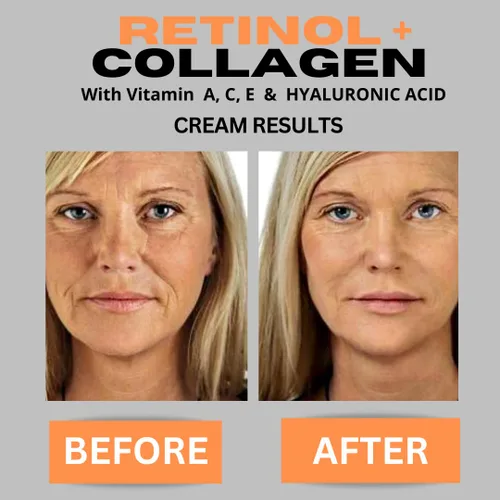 Vista 2 de Retinol + colágeno, ácido hialurónico, crema facial antienvejecimiento con vitamina C, crema hidratante de día y noche, crema antiarrugas