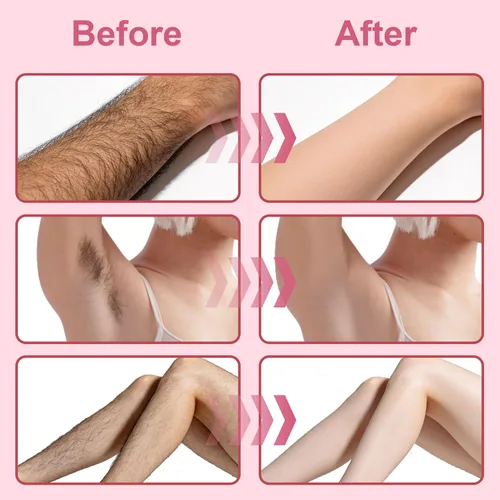 Vista 4 de Kit de cera para mujeres, kit de cera para depilación, olla de cera de 9