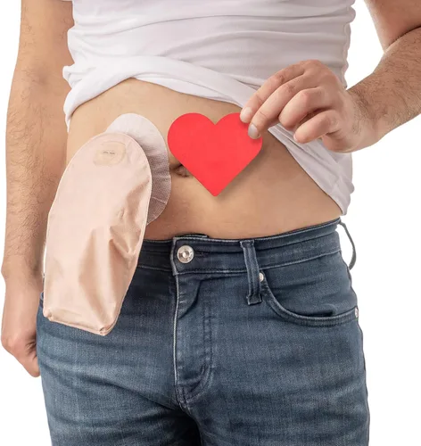 Vista 2 de 40pcs Skin Barrier Strip Elastic Ostomy Barrier Tape Waterproof Hydrocolloid Extenders Pressure Sensitive Sticker ostomy Supplies colostomy Supplies