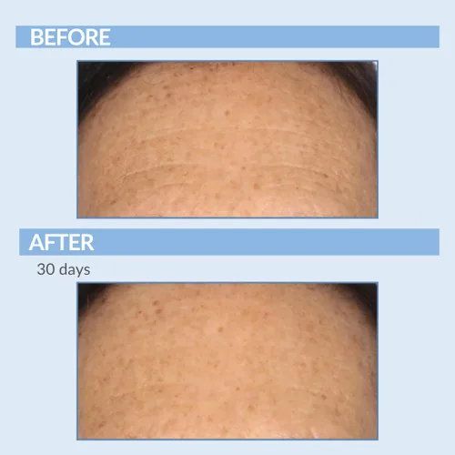 Vista 5 de Serious Skincare Un trío Defiance para cara y cuello – Anti-envejecimiento para líneas finas y arrugas – A Force XR Retinol Serum 1 oz – 4 millones