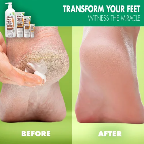 Vista 2 de Miracle Foot Repair Cream, (1 onza/3 unidades) repara talones y pies secos agrietados, 60% ultraaloe puro hidrata, suaviza y repara