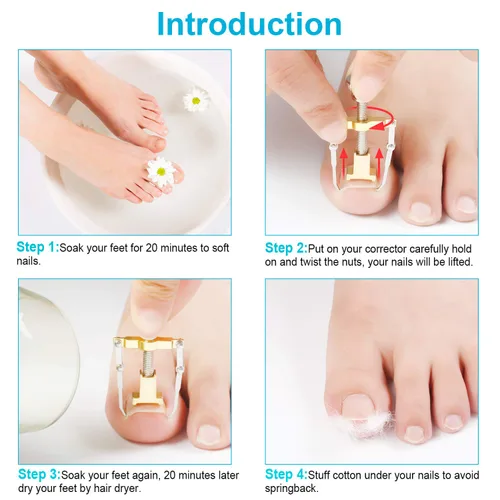 Vista 5 de 2 piezas encarnadas levantador de uñas encarnadas herramienta de uñas encarnadas abrazadera del dedo del pie de acero inoxidable herramienta