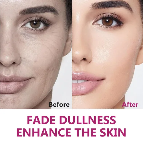 Vista 7 de AiRunTech Arbutina 8% y ácido tranexámico 5% crema, ayuda a desvanecer manchas oscuras, pecas, manchas y pigmentación, reafirma e hidrata la piel