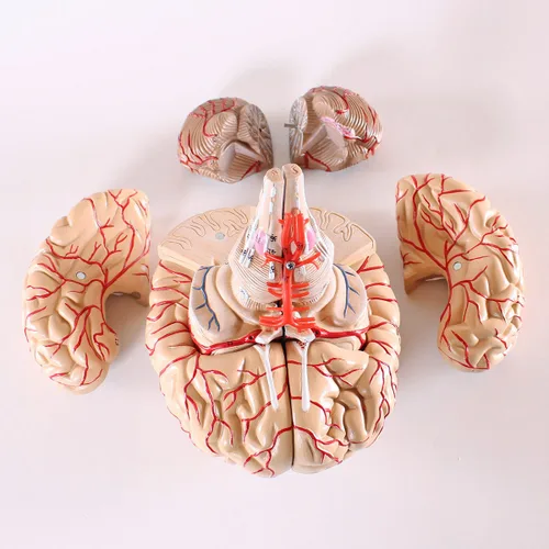 Vista 3 de Wellden Modelo anatómico de cerebro, de 9 partes, con arterias, tamaño real.