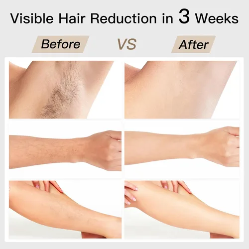 Vista 7 de Depilación láser, BoSidin depilación IPL con enfriamiento de hielo sin dolor, rejuvenecimiento facial SR 2 en 1, 6+1 modos, 6 niveles de depilación