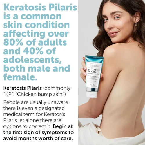 Vista 3 de Tratamiento de queratosis pilaris Loción de queratosis pilaris con 10% AHA Exfoliación suave para piernas de fresa, KP y pelos encarnados