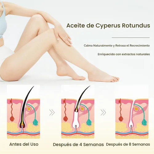 Vista 4 de Aceite Cyperus Rotundus para depilación: reduce el crecimiento no deseado del cabello, ralentiza el nuevo crecimiento, calma la piel y encoge