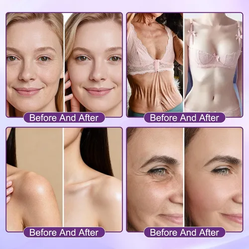 Vista 5 de Biotin - Crema de restauración de piel 10 en 1, suero de elevación de colágeno natural, crema profesional de tratamiento de la piel para eliminar