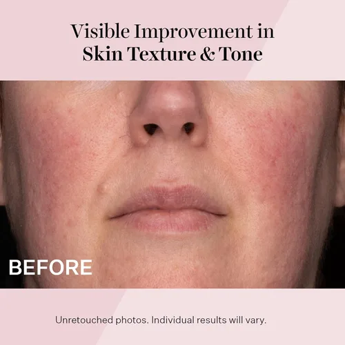 Vista 5 de StriVectin Advanced Retinol, Targets Visible Signs of Aging for Healthier Skin
