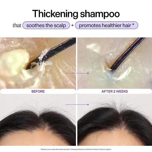 Vista 2 de Dr. Groot Champú para engrosar el cabello, cuidado coreano del cabello con biotina, aceite de romero para ayudar a dar volumen al adelgazamiento
