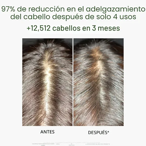 Vista 3 de Rene Furterer TRIPHASIC - Cabello adelgazante reaccionario