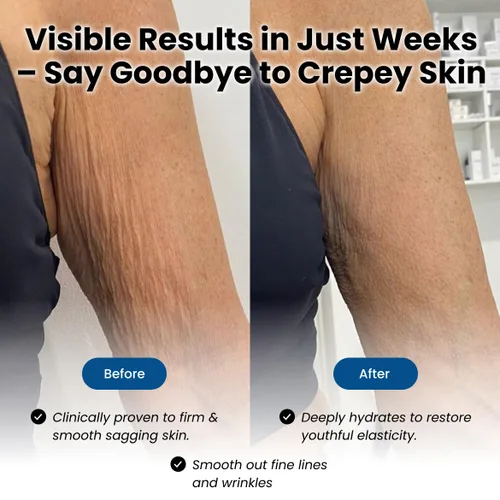 Vista 2 de Eliré Advanced Crepe Fix- Crema reafirmante y suavizante para piel crepey, envejecimiento - Hidrata, levanta y restaura la piel en brazos, piernas