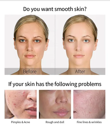 Vista 5 de Sueros faciales de caracol de oro de 24 quilates para mujeres, filtrado de secreción de caracol, suero de ácido hialurónico facial, esencia