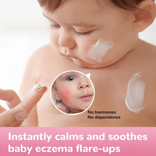 Vista 2 de Crema para aliviar el eccema del bebé, fórmula herbaria totalmente natural para una protección segura y calmante de la piel contra erupciones