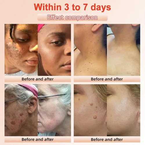 Vista 2 de Gel exfoliante purificador, limpiador facial y exfoliante de limpieza profunda para rostro y cuerpo, hidratante limpia la piel y limpia la suciedad