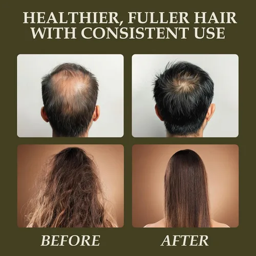 Vista 6 de era of nature Aceite de batana para el crecimiento del cabello, aprobado por el Dr. Sebi, 100% puro, crudo y sin refinar de Honduras, nutre